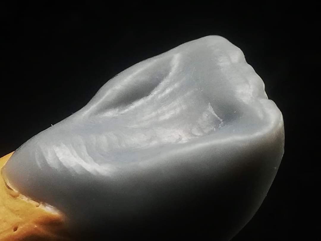 wax up y mock up